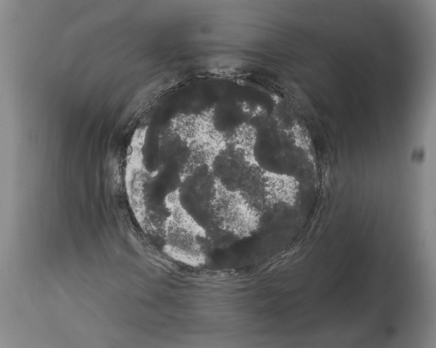 X0000113981106200911131048