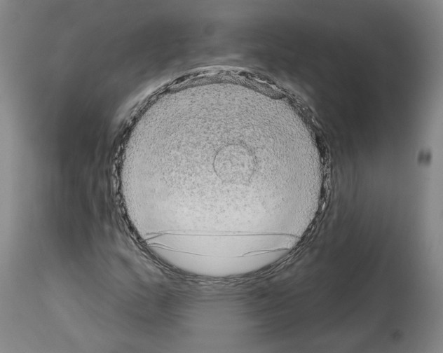 X0000113981159200911131048