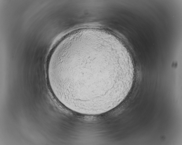 X0000113981176200911131048
