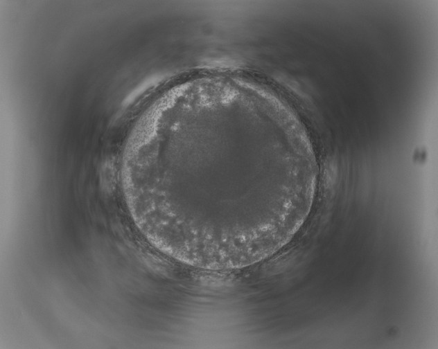 X0000113981254200911131047