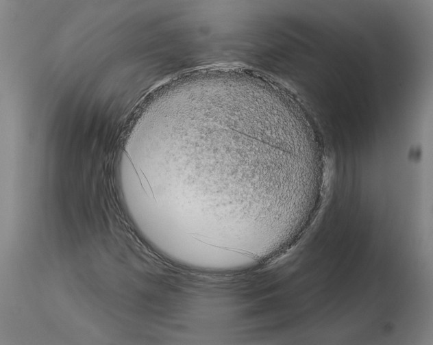 X0000113981257200911131047