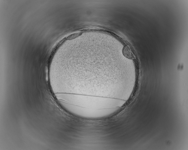 X0000113981269200911131047