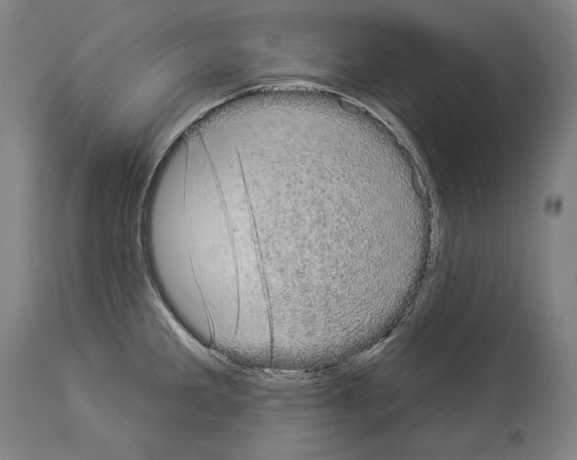 X0000113981285200911131047