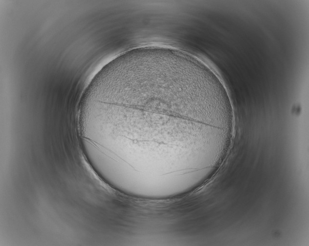 X0000113981293200911131047