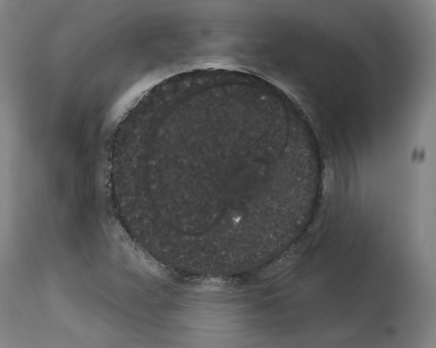 X0000113981359200911131045