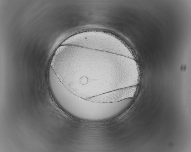 X0000113981365200911131045