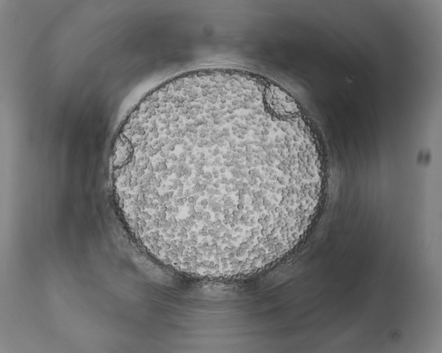 X0000113981366200911131045