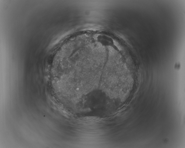 X0000113981399200911131044