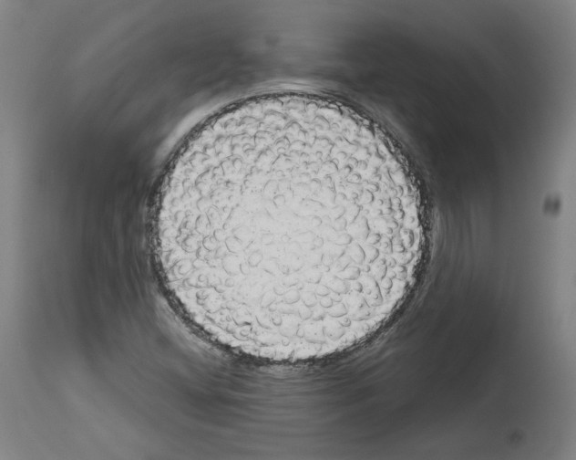 X0000113981404200911131044