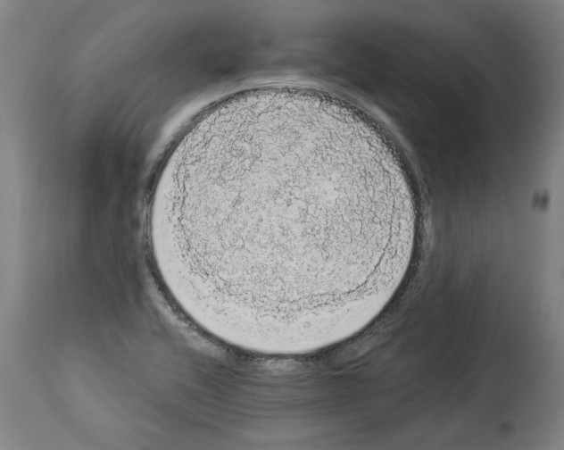 X0000113981416200911131045