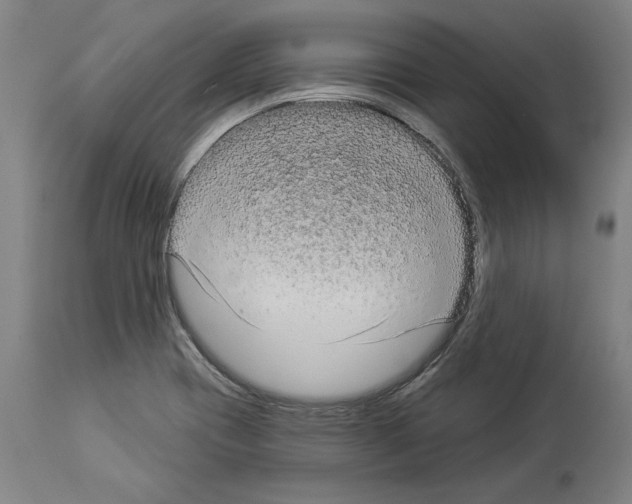 X0000113981417200911131045