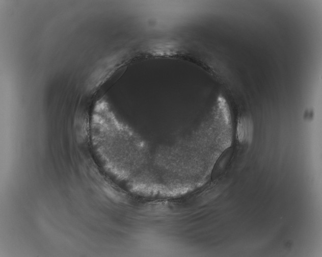 X0000113981444200911131044