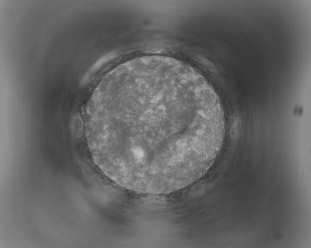 X0000113981446200911131044
