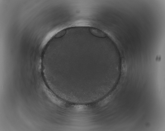 X0000113981461200911131044