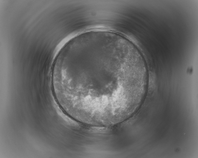 X0000113981474200911131044