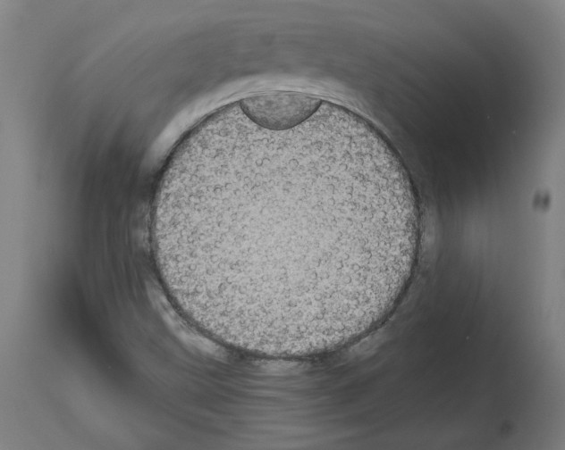 X0000113981499200911131043