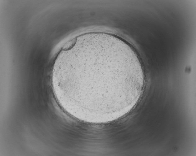 X0000113981504200911131043