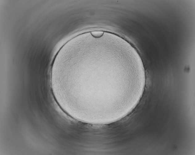 X0000113981516200911131043