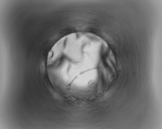 X0000113991106200910091332