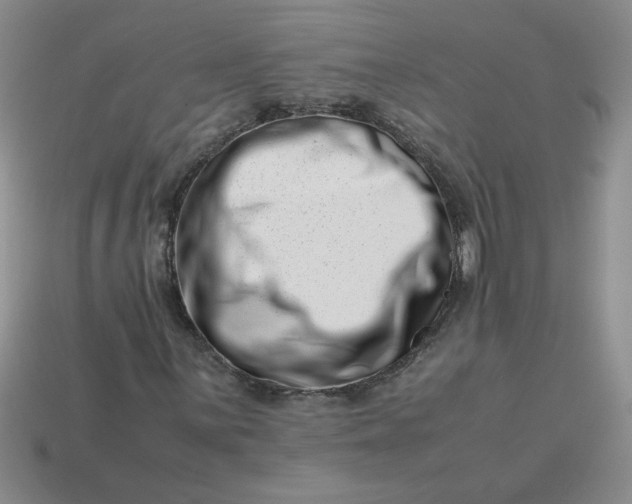 X0000113991059200910161641