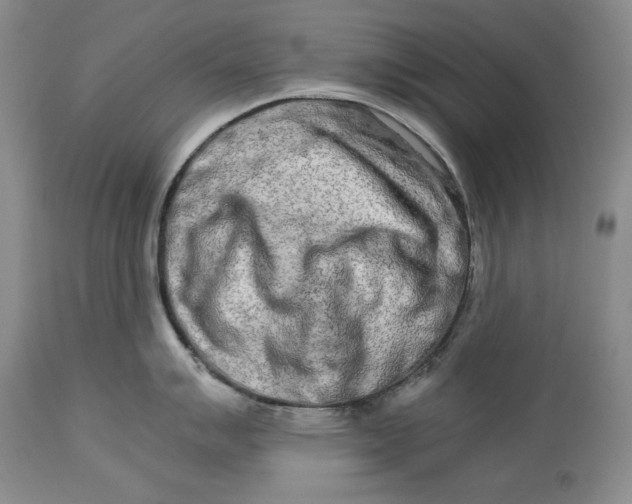 X0000113991007200910231725