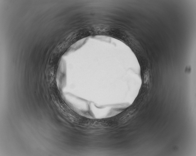 X0000113991011200910231725