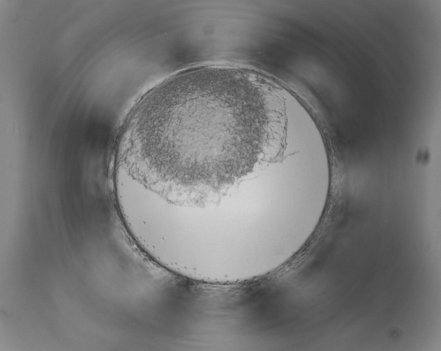 X0000113990856200911131116