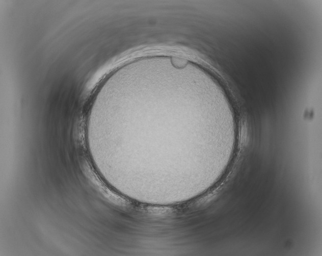 X0000113991498200911131106