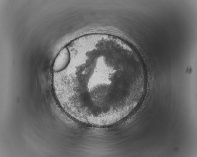 X0000113991506200911131106