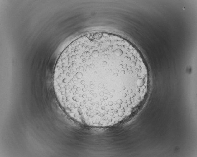 X0000113991529200911131107