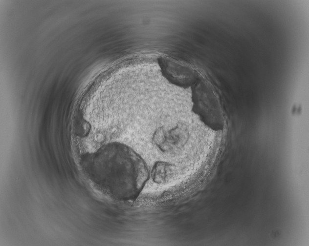X0000114000145200911131148