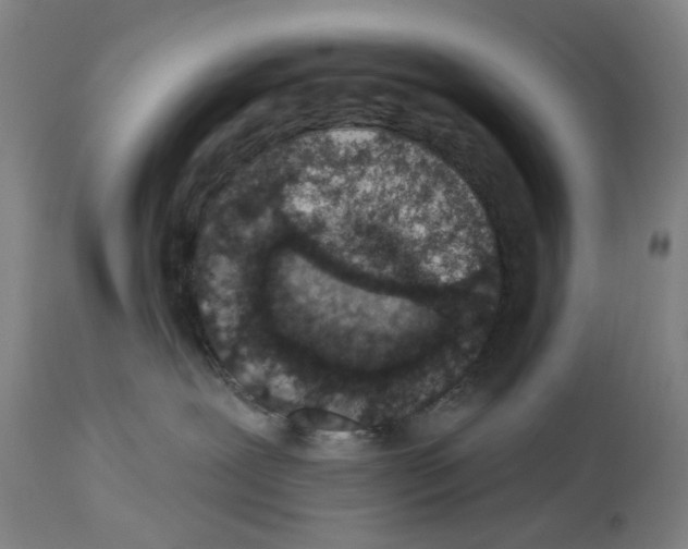 X0000114000239200911131148