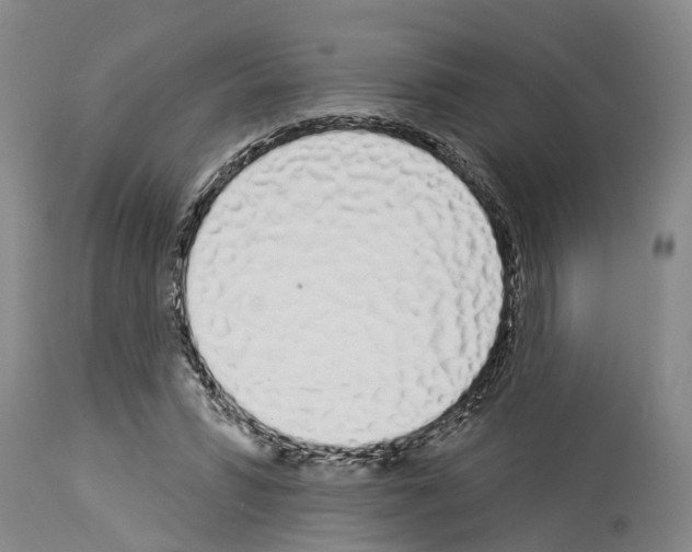 X0000114000399200911131145