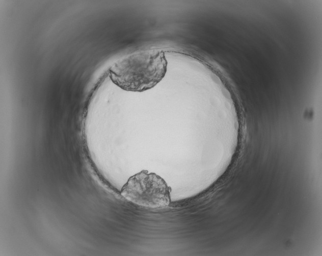 X0000114001416200911131130