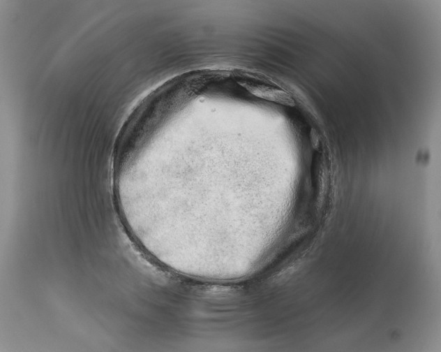 X0000114010839200910231813