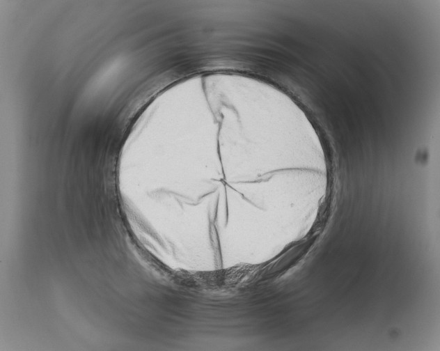 X0000114011137200911131158