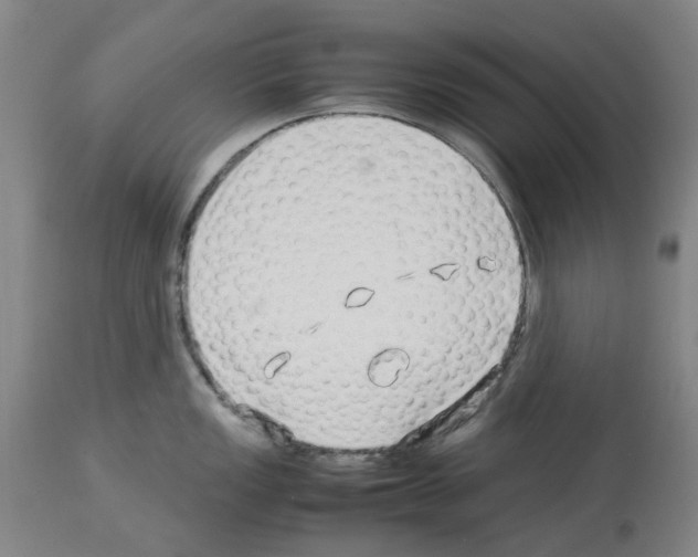 X0000114011149200911131158
