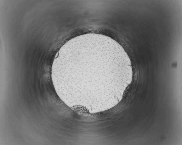 X0000114011156200911131157