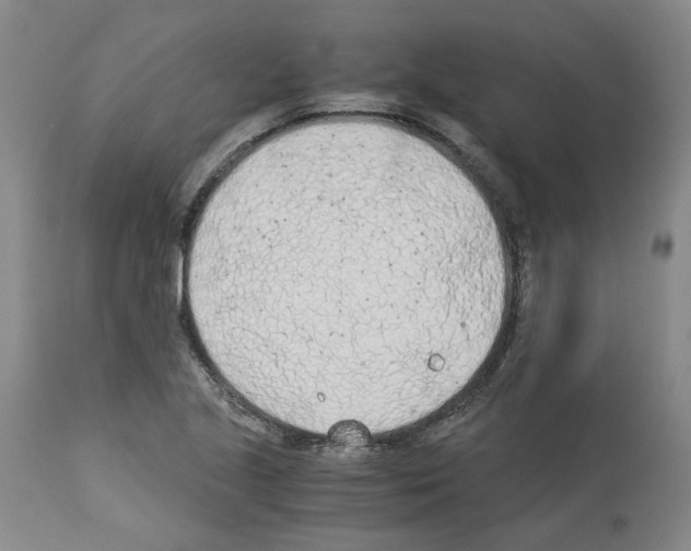 X0000114011221200911131156