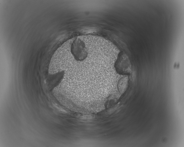 X0000114011393200911131152