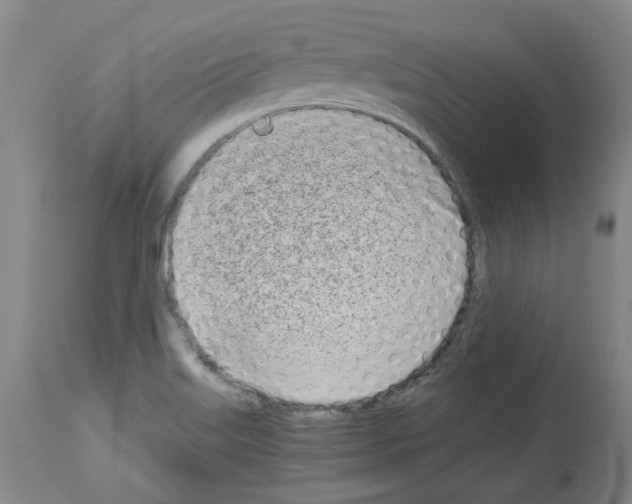 X0000114011515200911131151