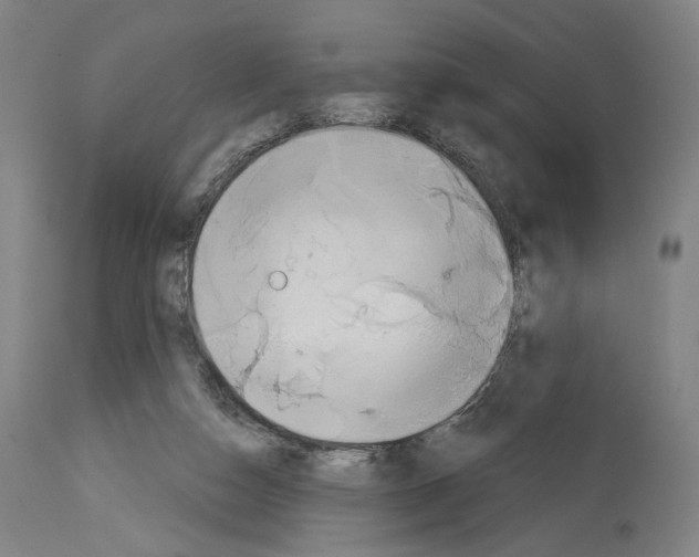 X0000114020162200911131235