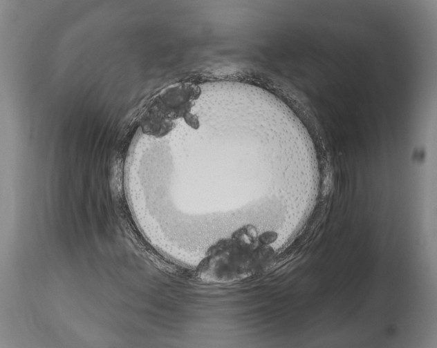 X0000114031156200911131243