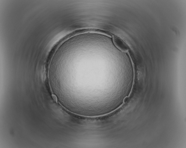 X0000114061069200910191456