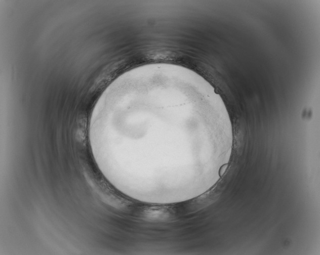 X0000114060175200911161137