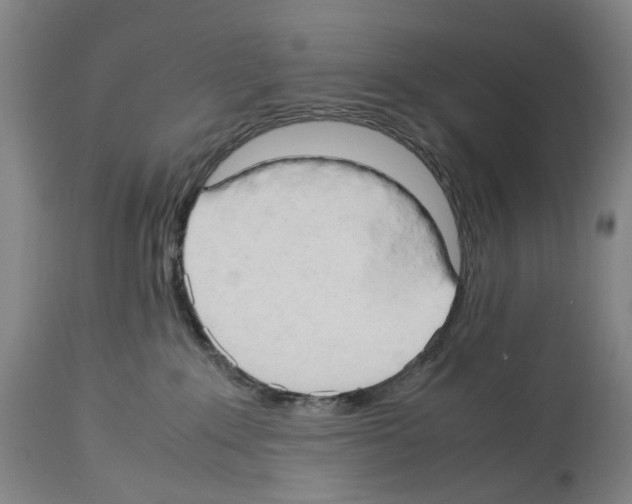 X0000114060235200911161136