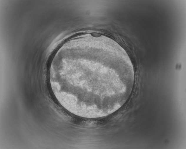 X0000114060295200911161135