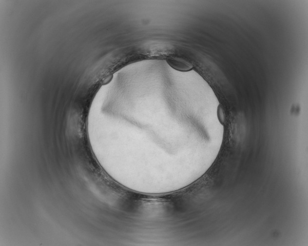 X0000114060316200911161135