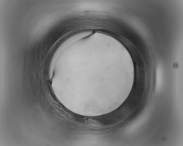 X0000114060387200911161133