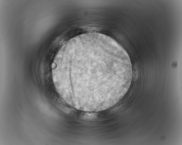 X0000114060573200911161131